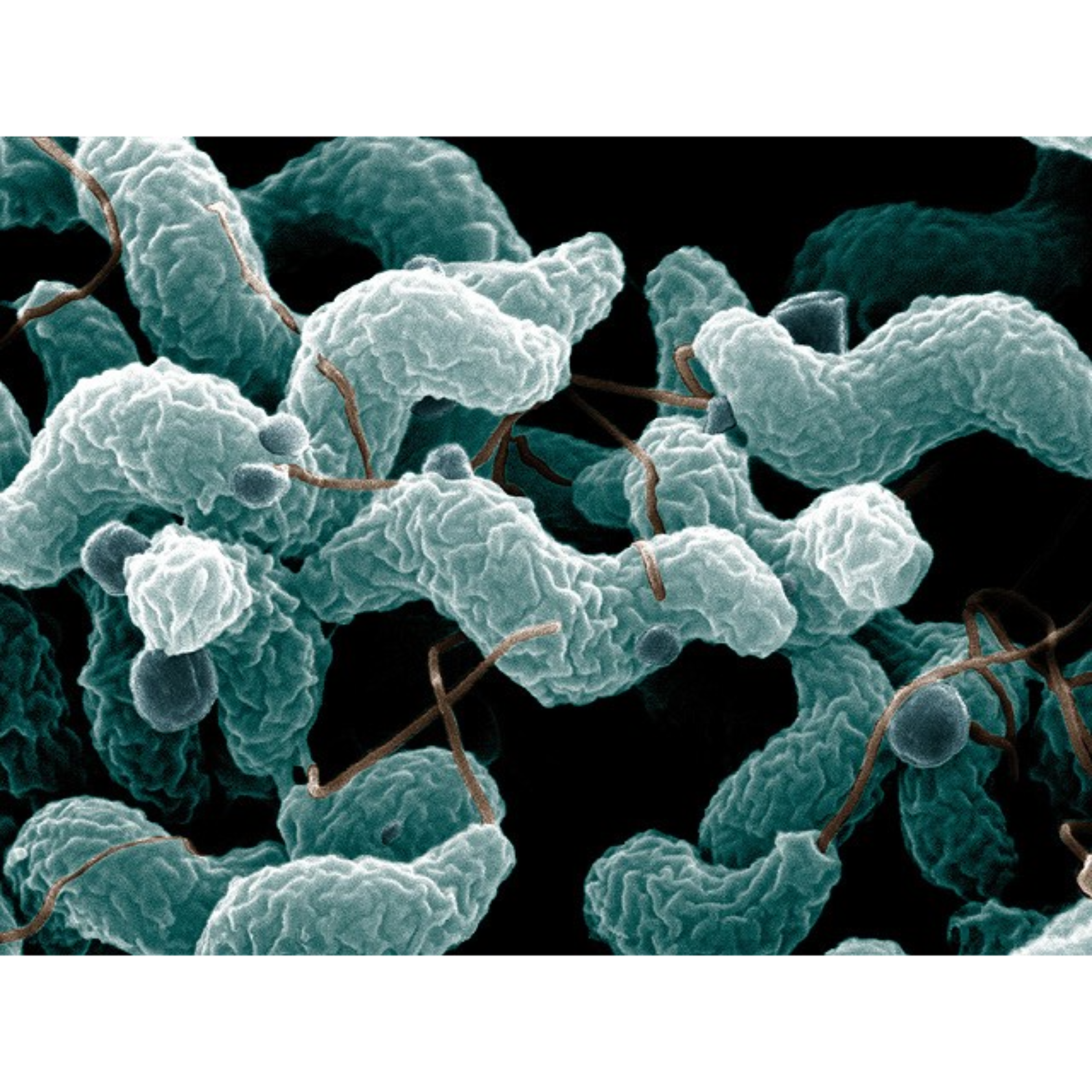 De Wood; Digital colorization by Chris Pooley., Mikroskopi av Campylobacter-bakterien. Photo by De Wood; digital colorization by Chris Pooley., Campylobacter 2021, , 